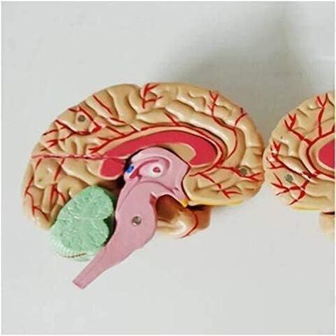 Cerebro con arterias desarmable-4
