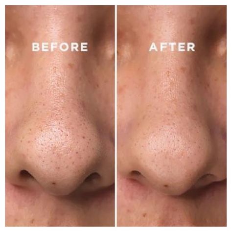 Tónico coreano para suavizar la piel con agua de corteza de sauce blanco - COSRX Two in One Poreless-2