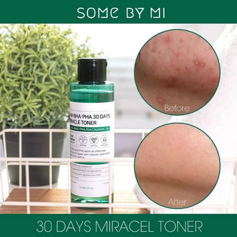 Tónico coreano para piel sensible con AHA - SOME BY MI Aha-Bha-Pha 30 Days Miracle Toner 150ml-2