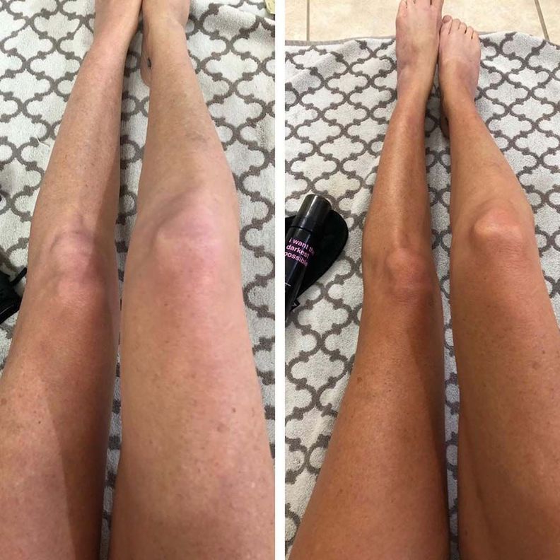 B.TAN AUTOBRONCEANTE CORPORAL-3