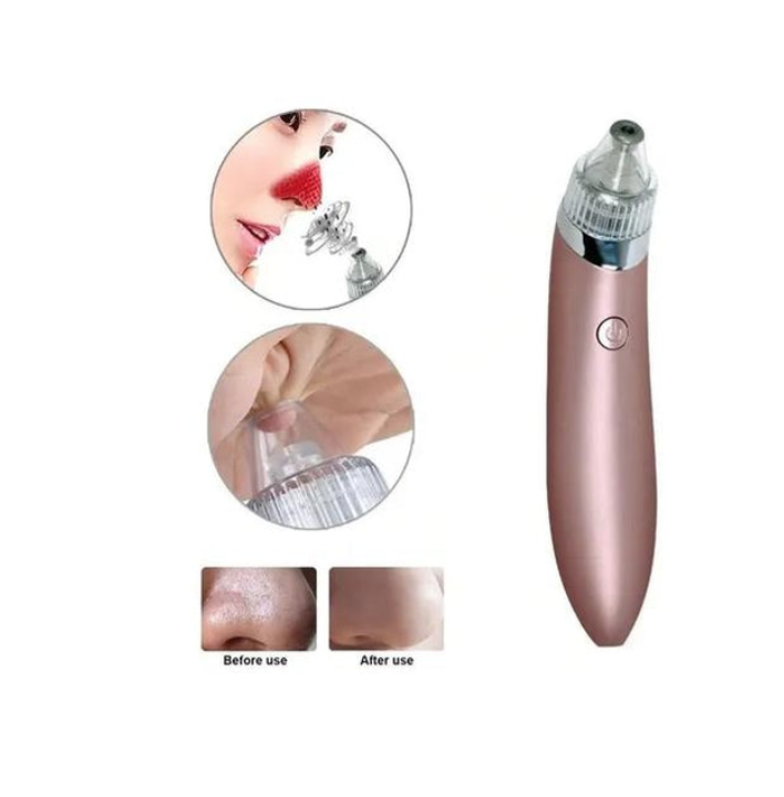 Removedor Extractor Puntos Negros Espinillas Limpieza Facial-1