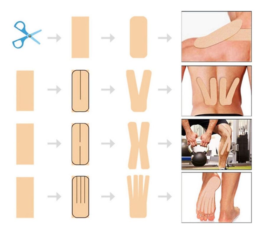 Cinta Kinesiológicas Vendaje Neuromuscular Tape X6pcs 5mx5cm - Norplat-2