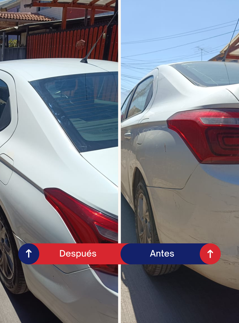 Kit de Lavado en Seco - Completo y Ecológico para Autos-4