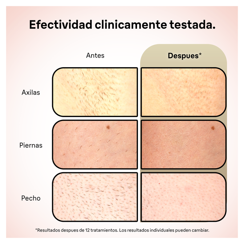 Depiladora Definitiva IPL Braun Luz Pulsada Silk  Pro5 Con Estuche-5