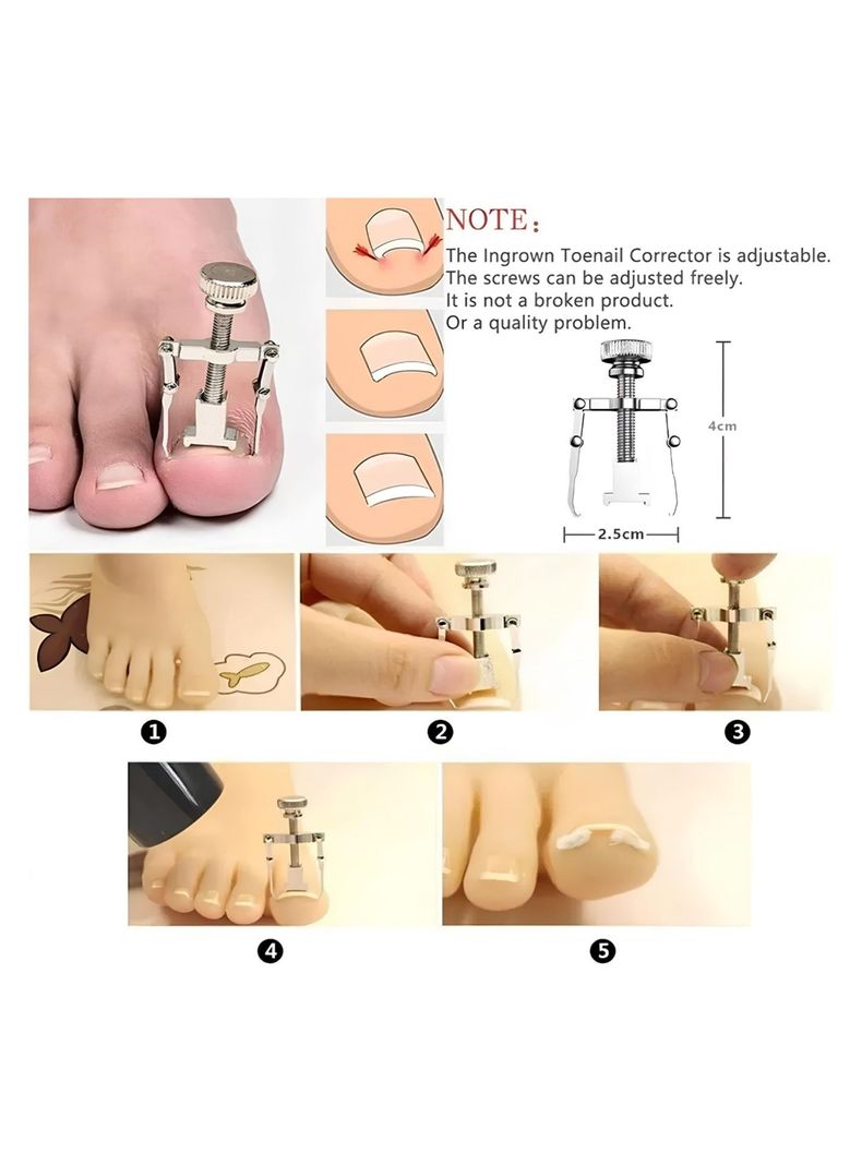 Set De Pedicura Herramientas Para Uñas Encarnadas-4