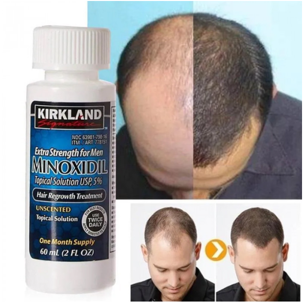 Minoxidil KIRKLANDS 5% Tratamiento Capilar Para 6 Meses-5