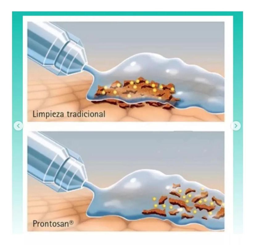 Prontosan Gel Lavado de Heridas 30 Ml Bbraun-3