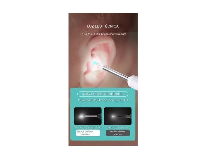 Limpiador Oídos Endoscopio Cámara Hd Inalámbrica Recargable-4