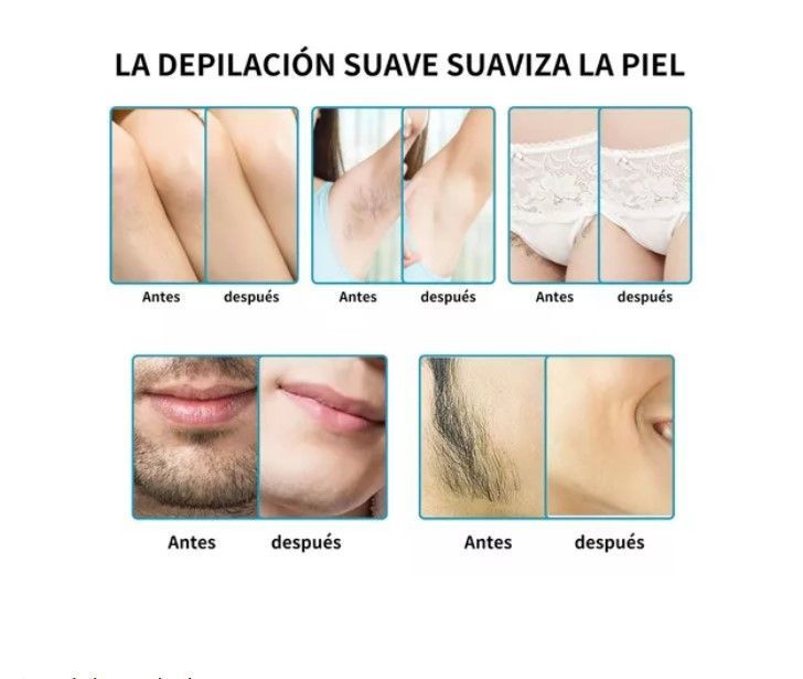 Olla De Cera Depilatoria Con Colador Y Filtro 6 Kilos-4