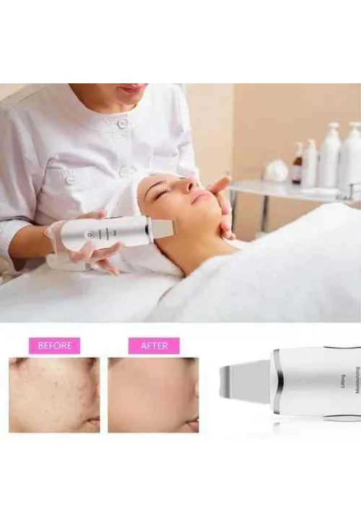 Paleta Ultrasonica Facial Limpiador Acne Limpiador 3-1-2