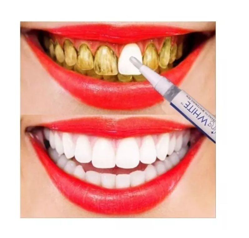 Pack X6 Lápiz Blanqueador Dientes Instantáneo-1