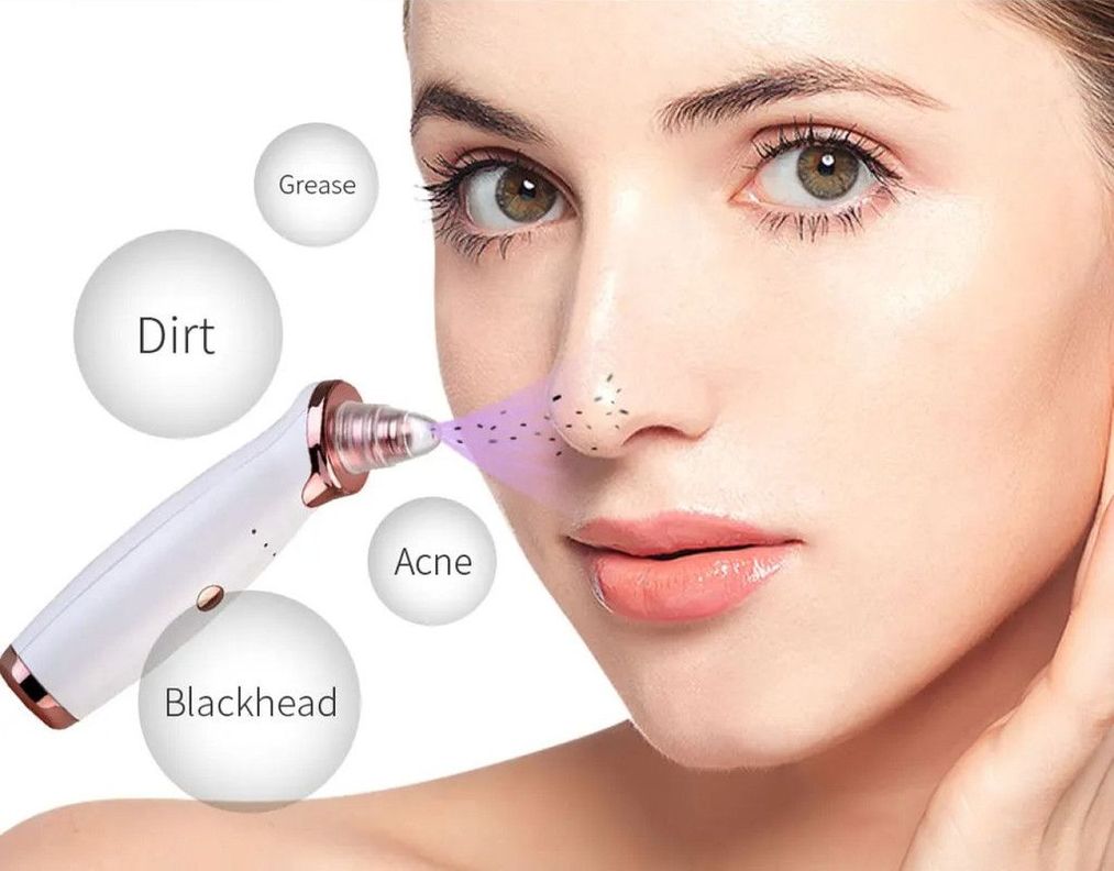Removedor Puntos Negros Espinilla Limpieza Facial 5en1 Usb-1