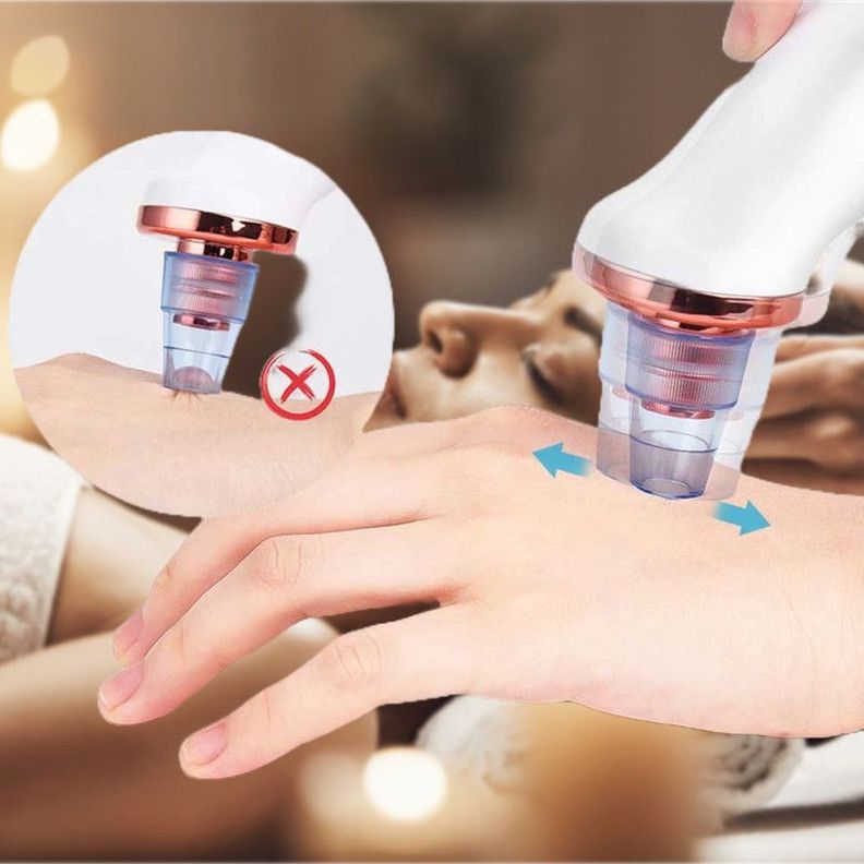 Removedor Puntos Negros Espinilla Limpieza Facial 5en1 Usb-4