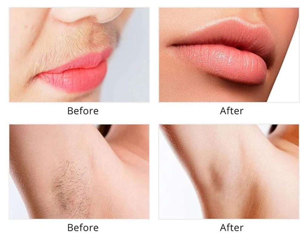 Depiladora Facial Removedor Cejas 2 en 1 Recargable Lau-3