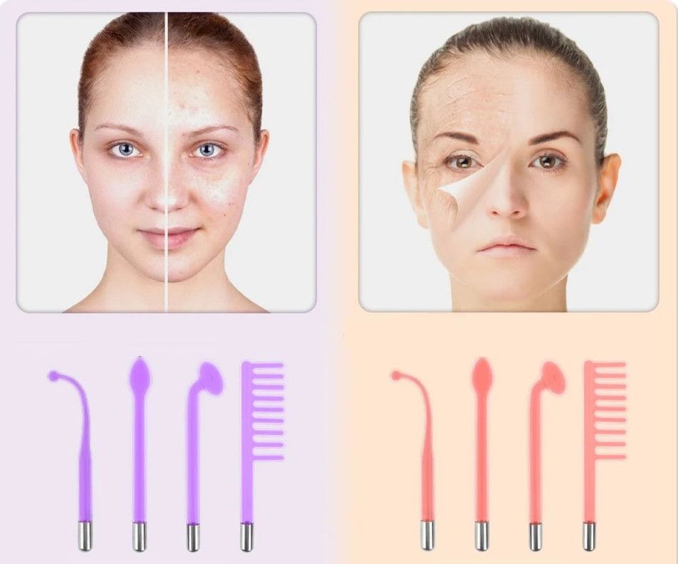 Maquina Removedor Mancha Portatil Alta Frecuencia Facial Lau-5