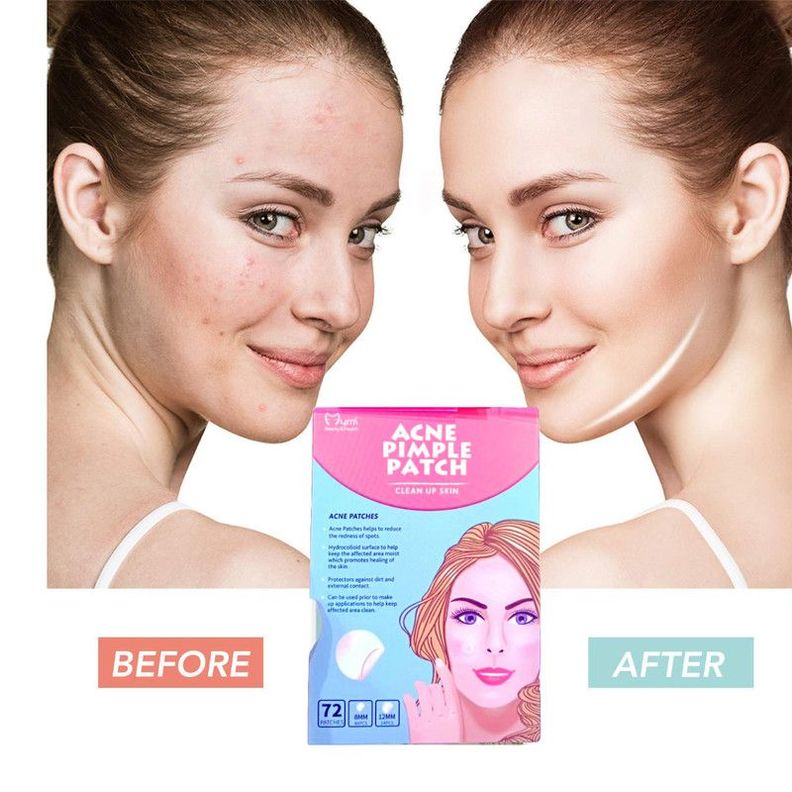 Set 3 Cajas Parche Anti-Acne Piel Facial Marcas Lau-3