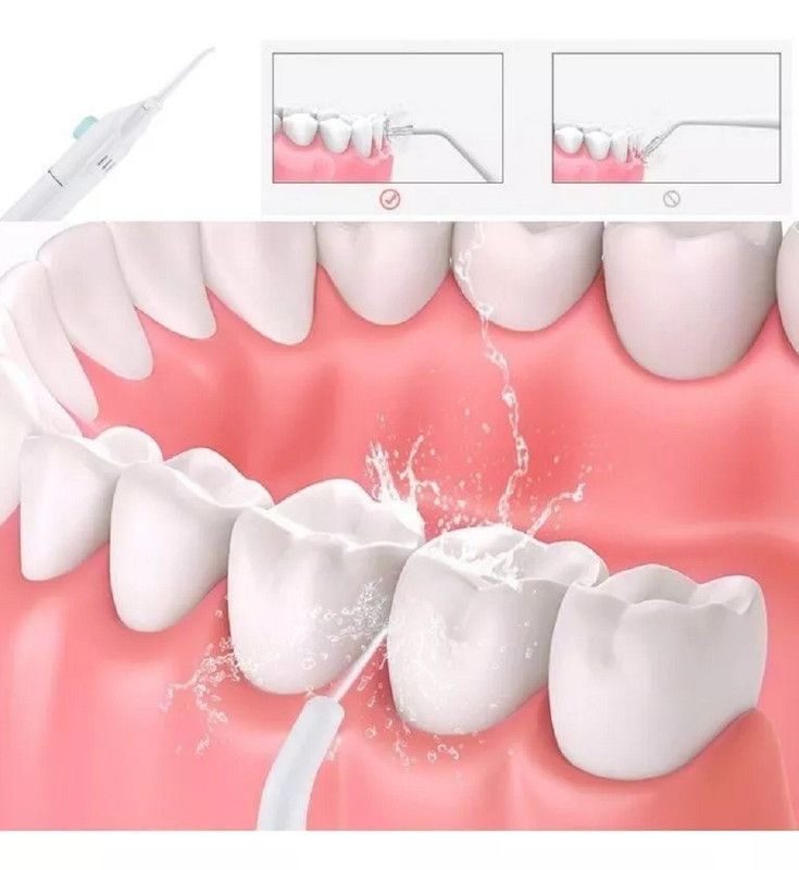 Set 3 Irrigador Limpiador Dental Agua Presión  Brackets Lau-2