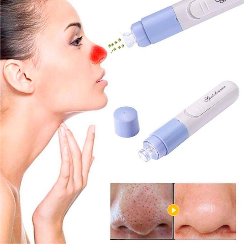 Limpiador y Extractor de Puntos Negros y Rostro-3