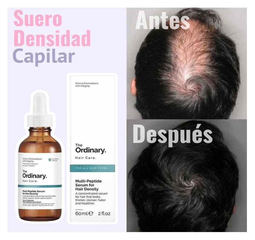 The Ordinary Serum Para Hacer Crecer El Pelo Evitar Su Caida-5