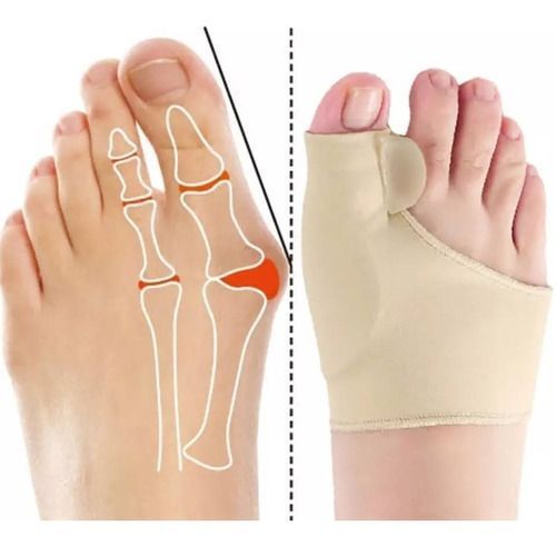 Corrector De Juanete Par Para Ambos Pies-5