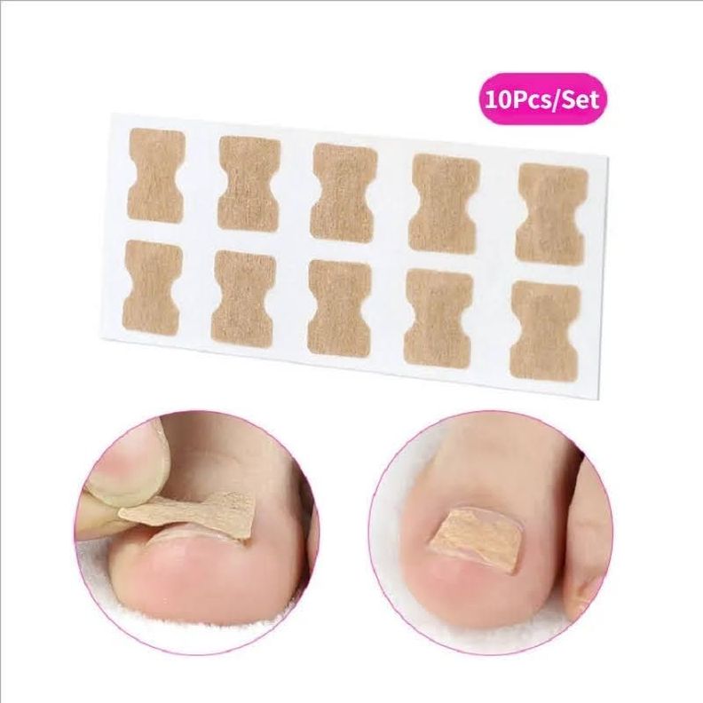 Pack x30 Parches Para Corregir Uña Encarnada Corrector Pie-4