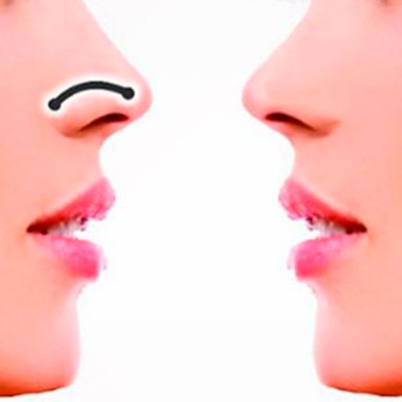 Corrector Nasal Respingador De Nariz Instantaneo-1