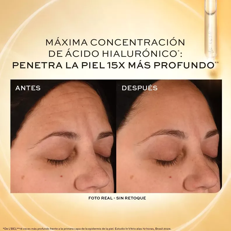 Concentre Serum Facial Relleno Arruga 15% Hyaluronic Complex-4