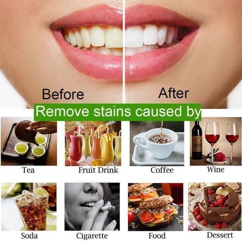 Blanqueador Dental Pasta Natural Carbon Miracle-6