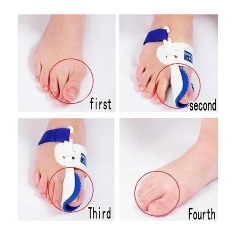 Corrector Juanetes , Ortesis Hallux Valgus-3