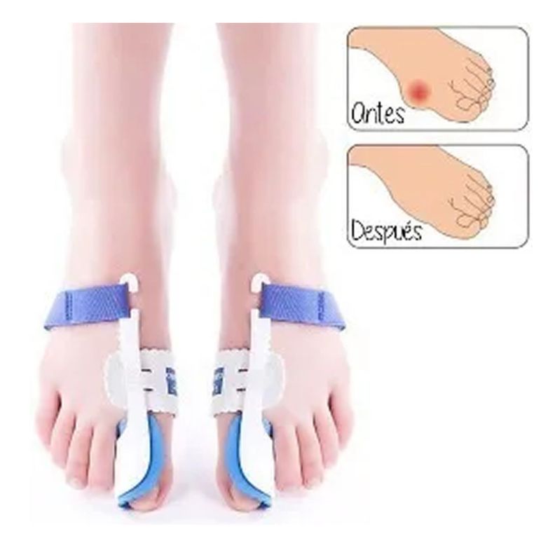 Corrector Juanetes , Ortesis Hallux Valgus-5
