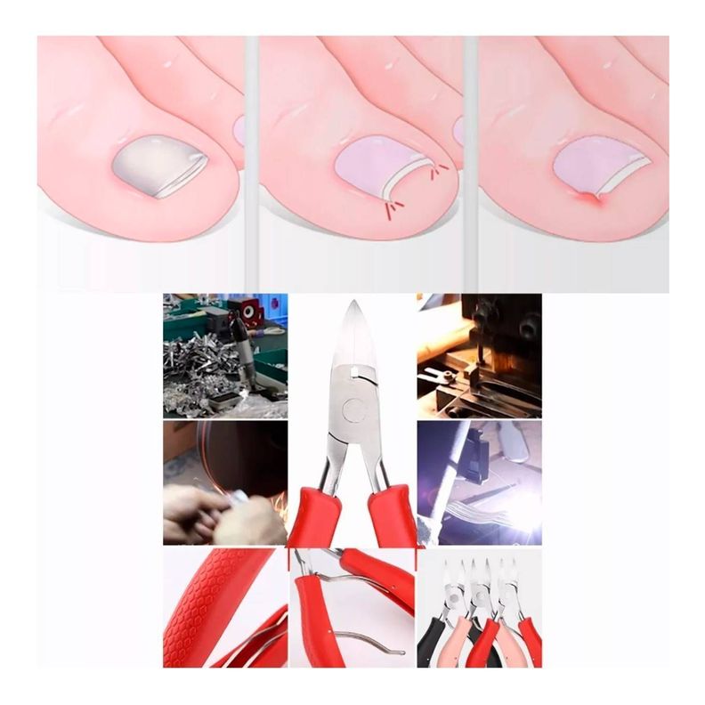 Set Pedicura Herramientas Uñas Encarnadas Acero In-2