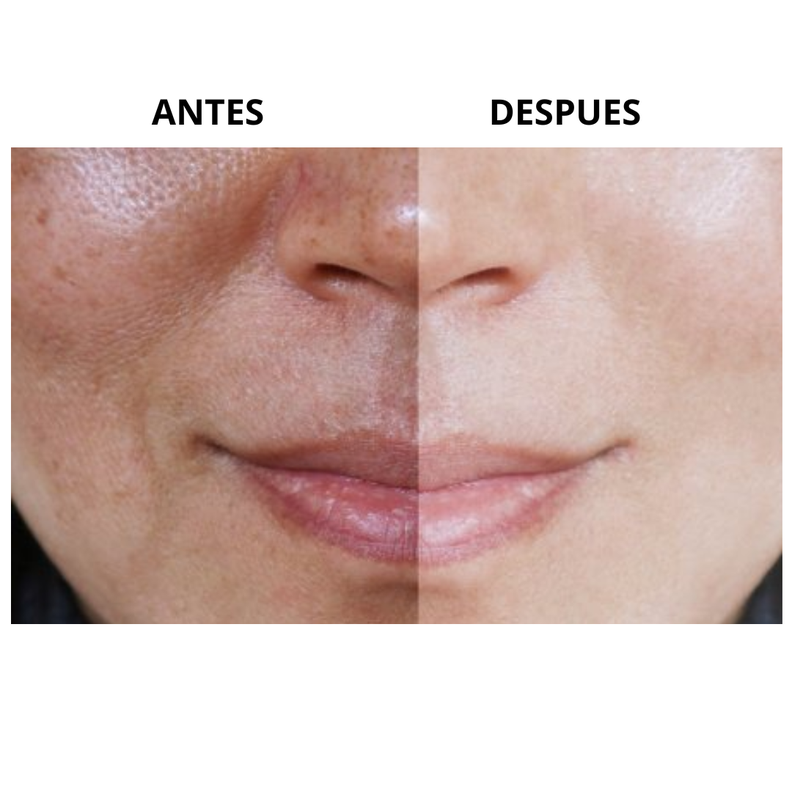 Crema Facial De Agua - Leche Aclarante-1