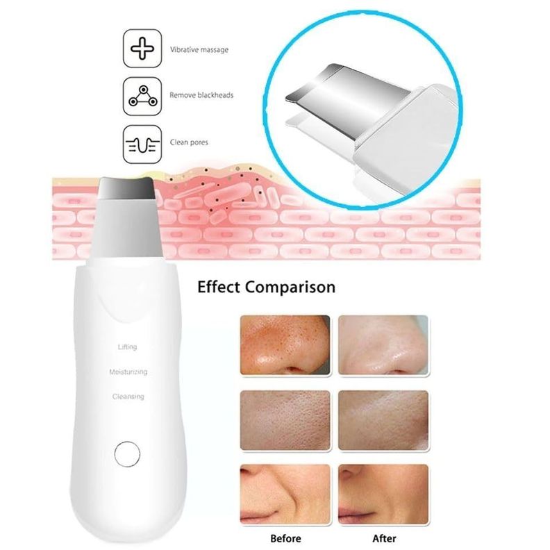Espátula Ultrasónica Paleta Ultrasónica Facial Limpiadora-3