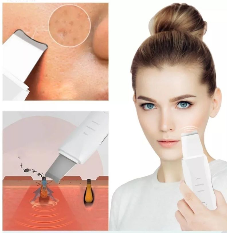 Espátula Ultrasónica Paleta Ultrasónica Facial Limpiadora-4