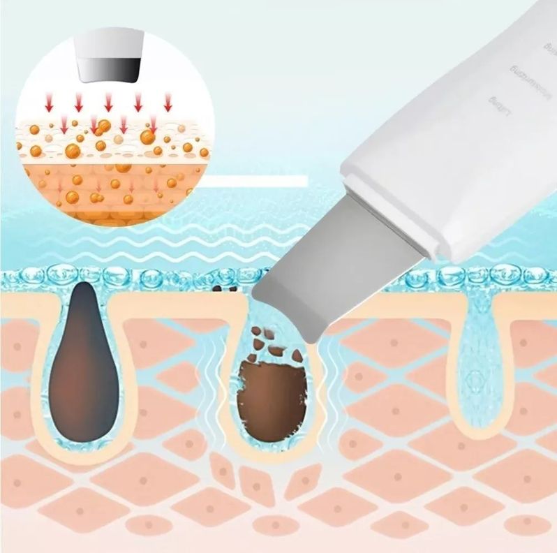 Espátula Ultrasónica Paleta Ultrasónica Facial Limpiadora-5