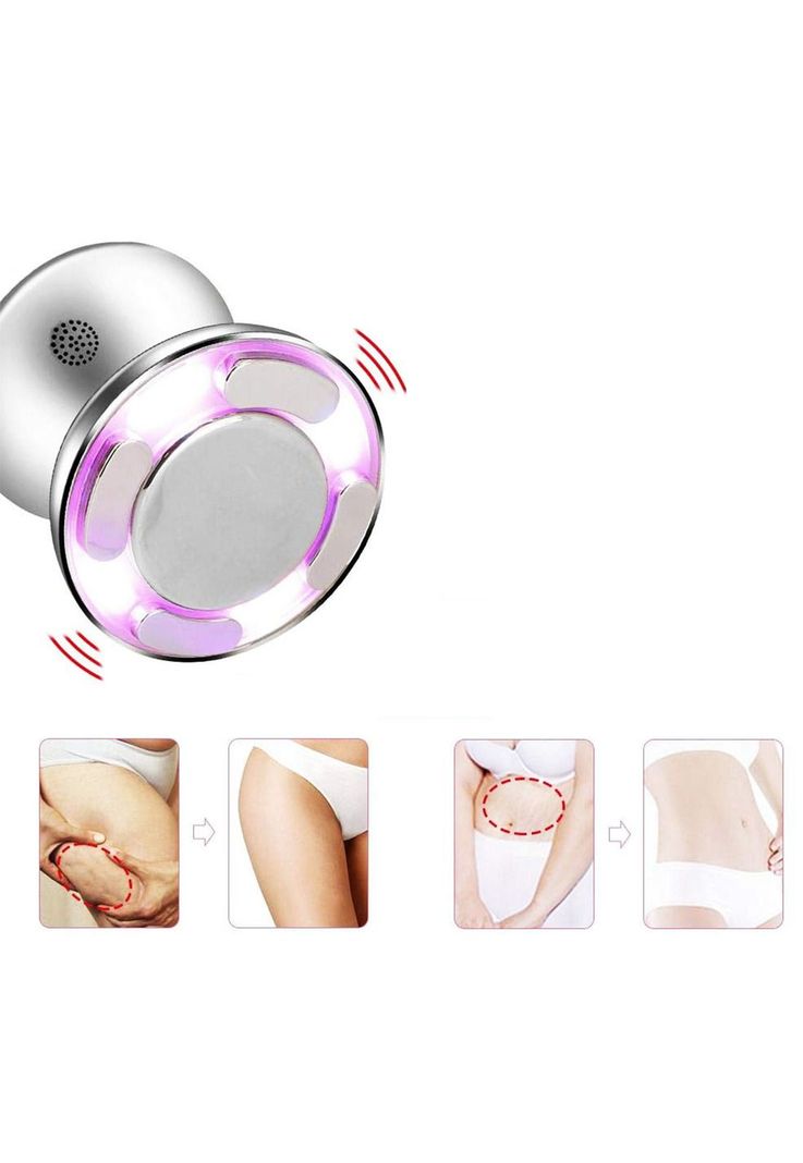 Cavitación Ultrasónica Nano IPL RF Adelgazante Anticelulitis-4