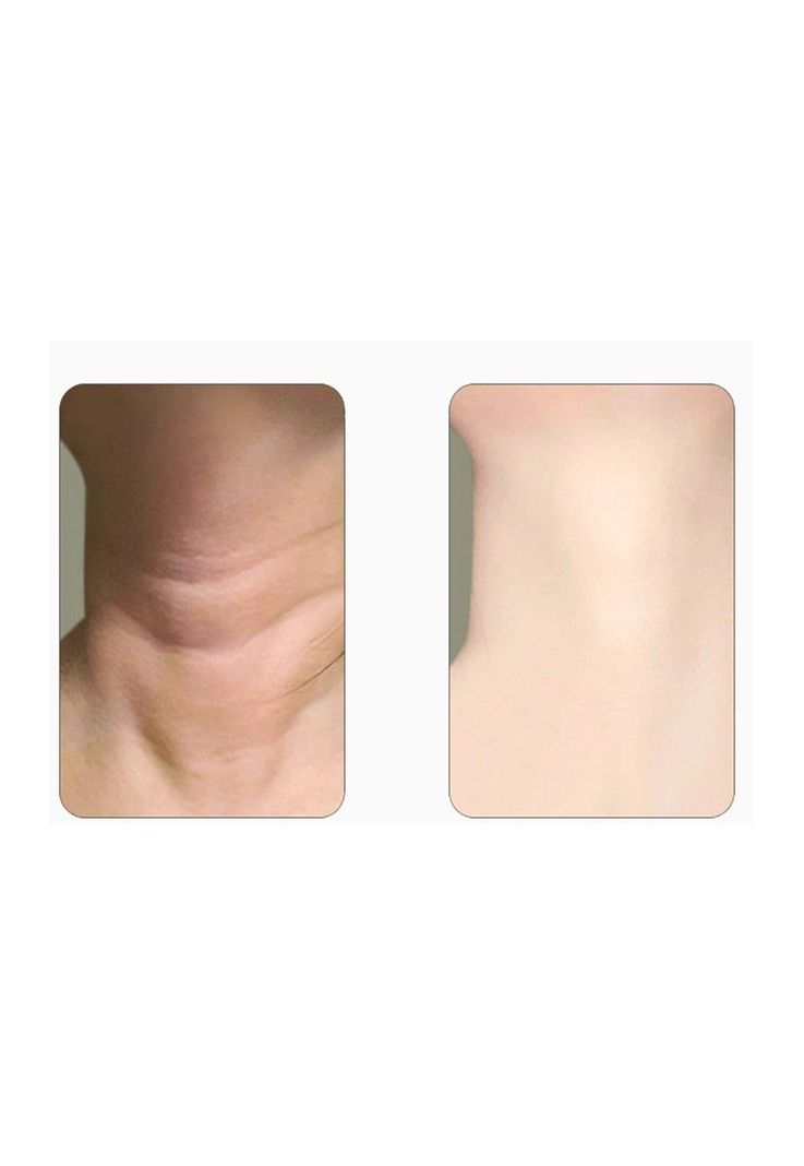 Masajeador Cuello Facial Papada Maquina Restauradora-3