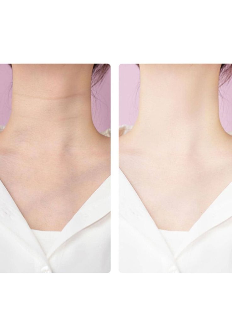 Masajeador Reductivo SkinCare Cuello Rostro Ultrasónico Blanco-3