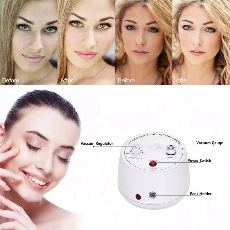 Microdermoabrasión Peeling Diamond Rejuvenecimiento Facial-4