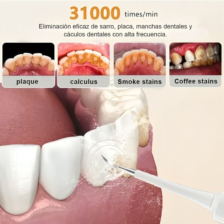 Kit Cepillo Limpiador Dental Eléctrico Ultrasónico Removedor-4