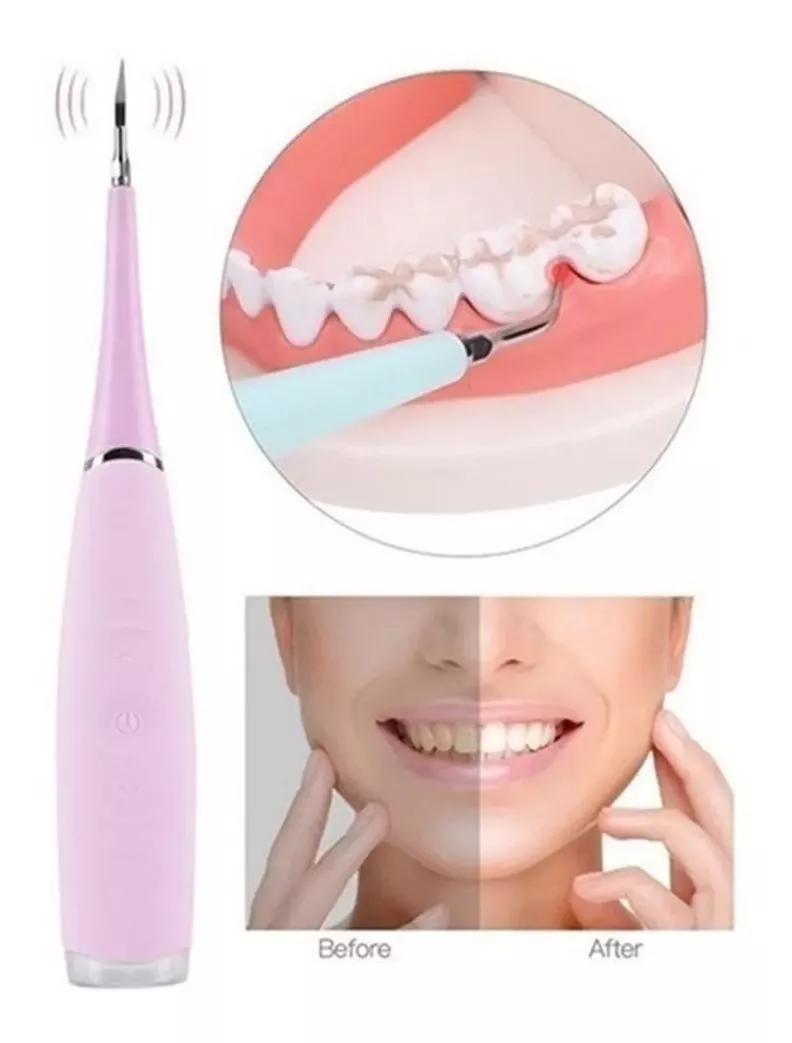 Eliminador De Sarro Dental Removedor De Sarro Usb rosa-1