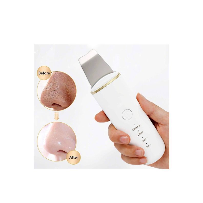 Limpiador Ultrasónico Facial Lifting - PuntoStore-1