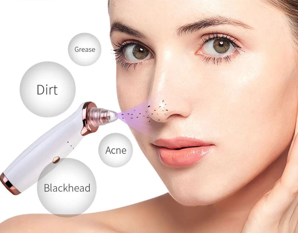 Removedor Puntos Negros Espinilla Limpieza Facial 5en1 Usb-1