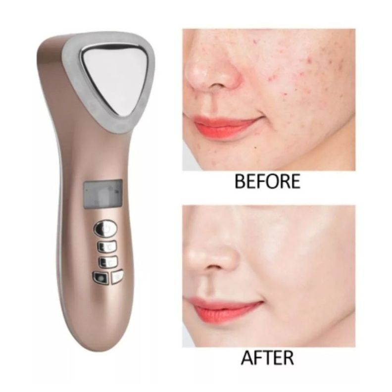Maquina Crioterapia Ultrasónica Limpiador Facial Frio Y Calor-2