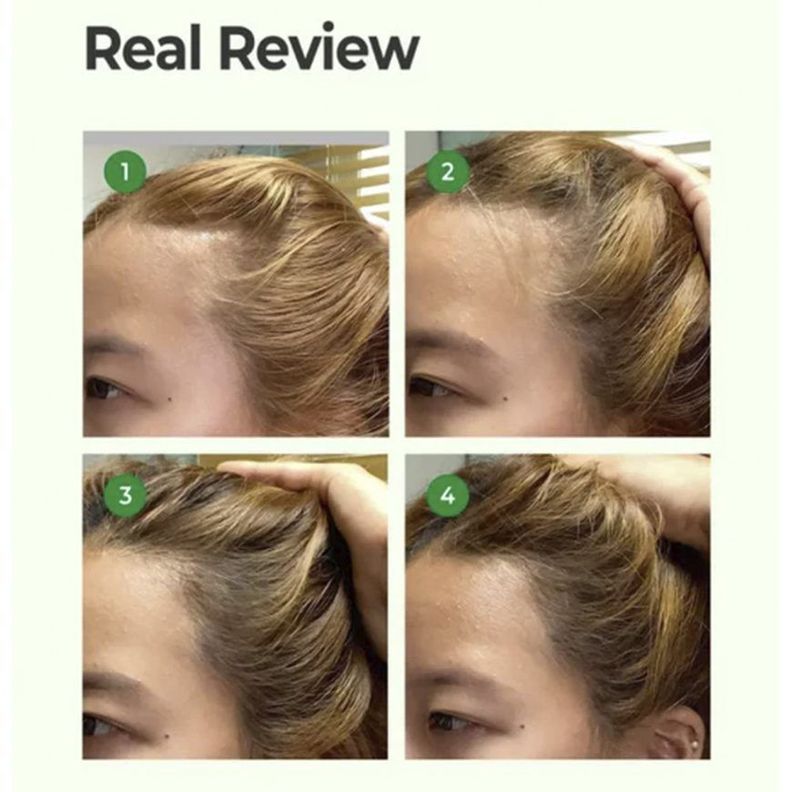 Shampoo con extractos de ginseng coreano para cabellos dañados - DAENG GI MEO RI Ki Gold Premium-2