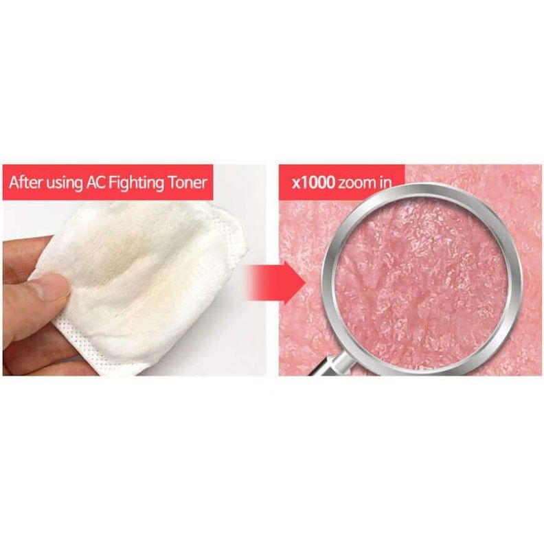 Tónico coreano descongestionante con ingredientes AHA, BHA y PHA - AC Fighting Toner TIAM-2