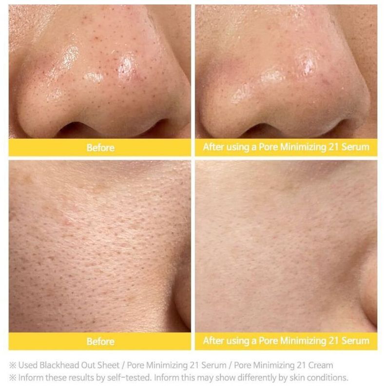 Sérum coreano minimizador de poros con niacinamida y ZINC - Pore Minimizing 21 Serum TIAM-1