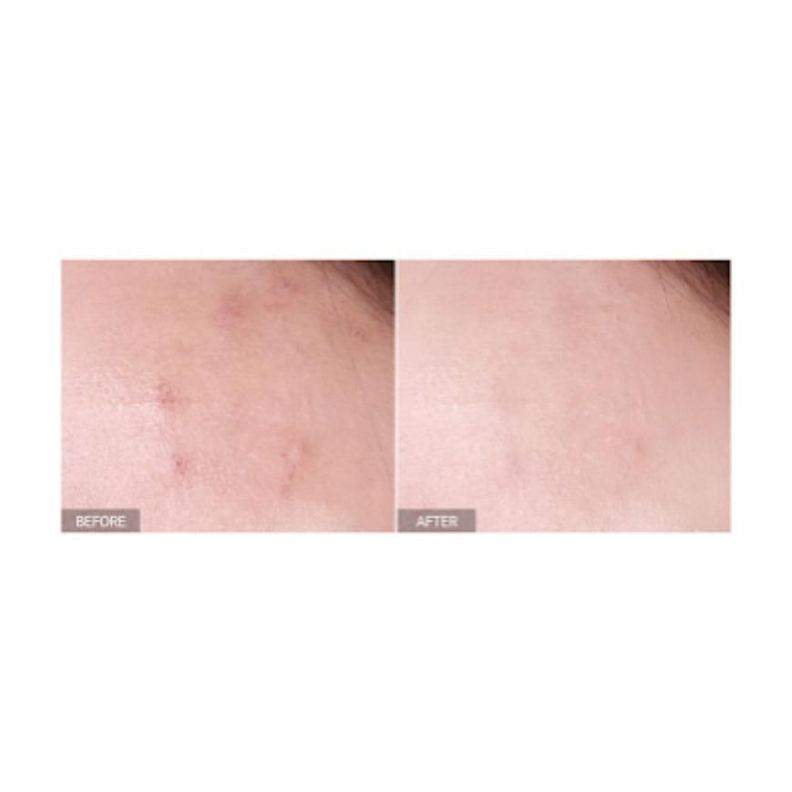Serum antimanchas con Niacinamida y Arbutina-3