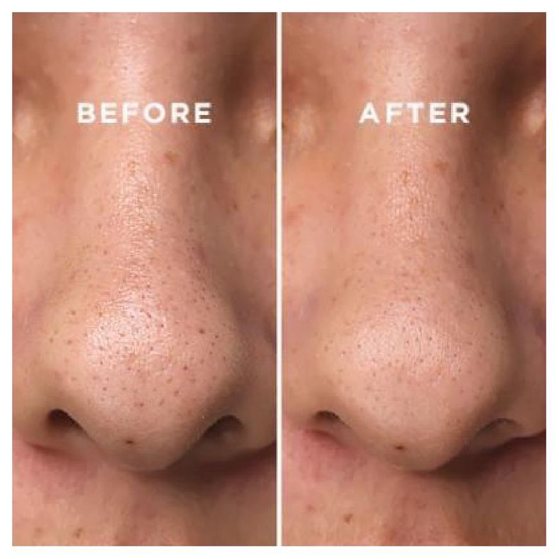 Tónico coreano para suavizar la piel con agua de corteza de sauce blanco - COSRX Two in One Poreless-2