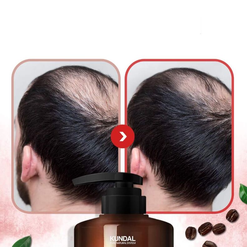 Champú coreano anti-caída con cafeína y ácido salicílico - KUNDAL Baby Powder-2